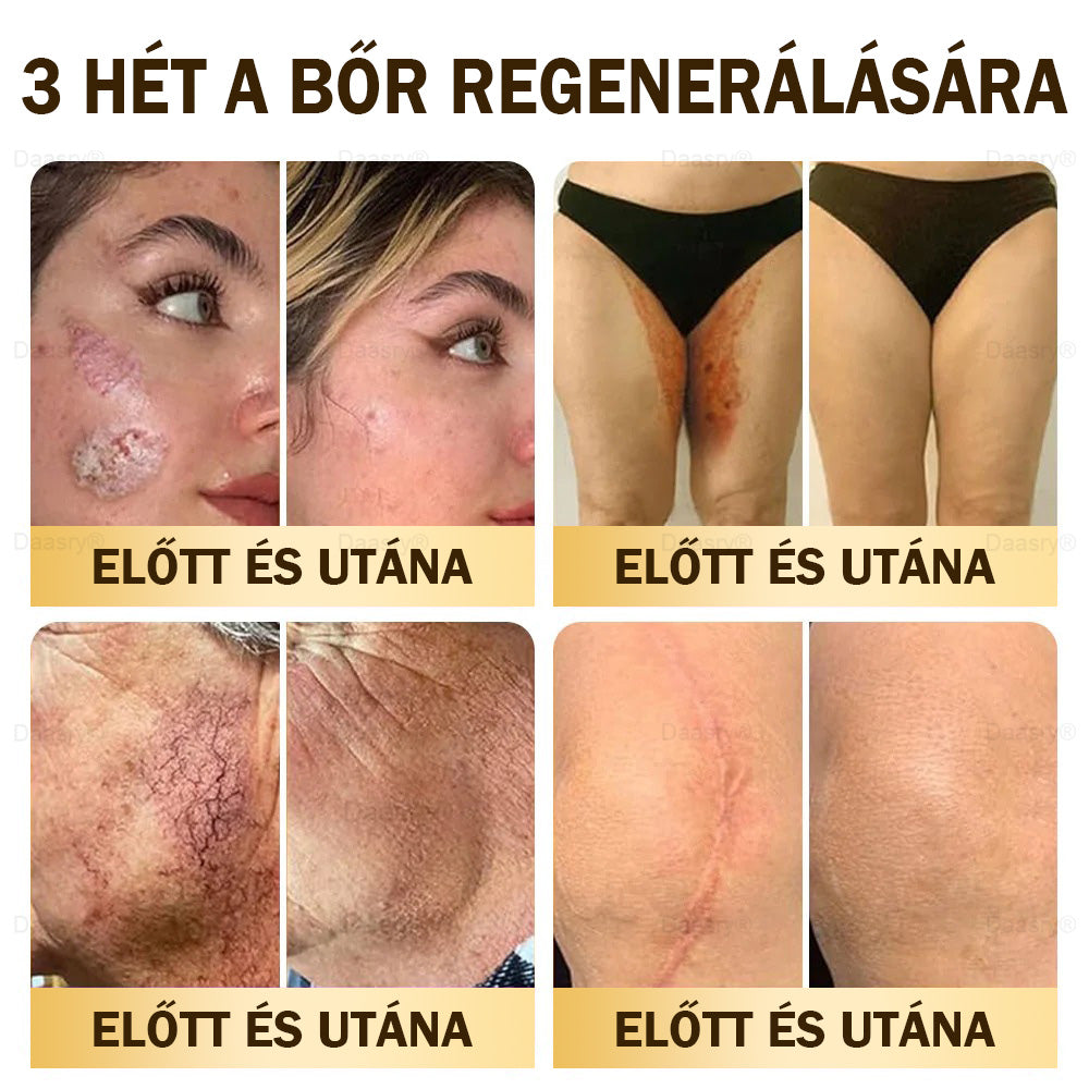 Most 25% kedvezmény!🎇𝓓𝓪𝓪𝓼𝓻𝔂® 𝑴é𝒉𝒎é𝒓𝒆𝒈 𝑩ő𝒓𝒋𝒂𝒗í𝒕ó é𝒔 𝑨𝒏𝒕𝒊-𝑨𝒈𝒊𝒏𝒈 𝑲𝒓é𝒎 – ránctalanítás, hidratálás, bőrkiegyenlítés, hegek gyógyítása, érzékeny bőr nyugtatása, egyenletes bőrtónus