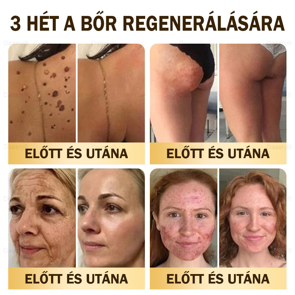 Most 25% kedvezmény!🎇𝓓𝓪𝓪𝓼𝓻𝔂® 𝑴é𝒉𝒎é𝒓𝒆𝒈 𝑩ő𝒓𝒋𝒂𝒗í𝒕ó é𝒔 𝑨𝒏𝒕𝒊-𝑨𝒈𝒊𝒏𝒈 𝑲𝒓é𝒎 – ránctalanítás, hidratálás, bőrkiegyenlítés, hegek gyógyítása, érzékeny bőr nyugtatása, egyenletes bőrtónus