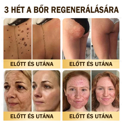 Most 25% kedvezmény!🎇𝓓𝓪𝓪𝓼𝓻𝔂® 𝑴é𝒉𝒎é𝒓𝒆𝒈 𝑩ő𝒓𝒋𝒂𝒗í𝒕ó é𝒔 𝑨𝒏𝒕𝒊-𝑨𝒈𝒊𝒏𝒈 𝑲𝒓é𝒎 – ránctalanítás, hidratálás, bőrkiegyenlítés, hegek gyógyítása, érzékeny bőr nyugtatása, egyenletes bőrtónus