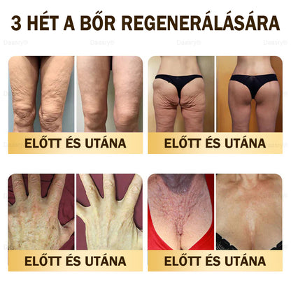 Most 25% kedvezmény!🎇𝓓𝓪𝓪𝓼𝓻𝔂® 𝑴é𝒉𝒎é𝒓𝒆𝒈 𝑩ő𝒓𝒋𝒂𝒗í𝒕ó é𝒔 𝑨𝒏𝒕𝒊-𝑨𝒈𝒊𝒏𝒈 𝑲𝒓é𝒎 – ránctalanítás, hidratálás, bőrkiegyenlítés, hegek gyógyítása, érzékeny bőr nyugtatása, egyenletes bőrtónus