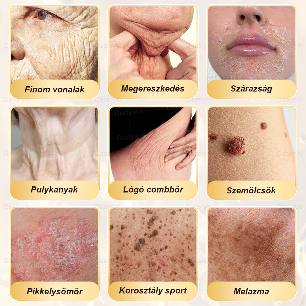 Most 25% kedvezmény!🎇𝓓𝓪𝓪𝓼𝓻𝔂® 𝑴é𝒉𝒎é𝒓𝒆𝒈 𝑩ő𝒓𝒋𝒂𝒗í𝒕ó é𝒔 𝑨𝒏𝒕𝒊-𝑨𝒈𝒊𝒏𝒈 𝑲𝒓é𝒎 – ránctalanítás, hidratálás, bőrkiegyenlítés, hegek gyógyítása, érzékeny bőr nyugtatása, egyenletes bőrtónus