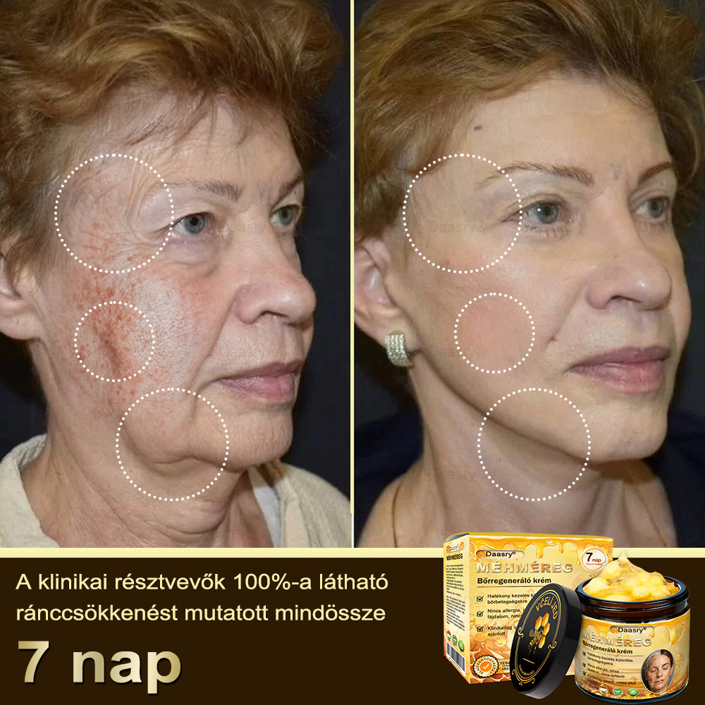 Most 25% kedvezmény!🎇𝓓𝓪𝓪𝓼𝓻𝔂® 𝑴é𝒉𝒎é𝒓𝒆𝒈 𝑩ő𝒓𝒋𝒂𝒗í𝒕ó é𝒔 𝑨𝒏𝒕𝒊-𝑨𝒈𝒊𝒏𝒈 𝑲𝒓é𝒎 – ránctalanítás, hidratálás, bőrkiegyenlítés, hegek gyógyítása, érzékeny bőr nyugtatása, egyenletes bőrtónus