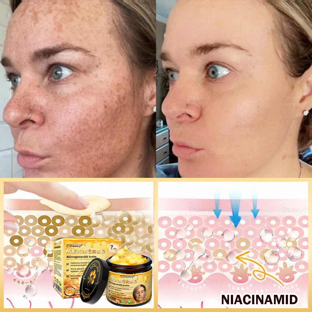 Most 25% kedvezmény!🎇𝓓𝓪𝓪𝓼𝓻𝔂® 𝑴é𝒉𝒎é𝒓𝒆𝒈 𝑩ő𝒓𝒋𝒂𝒗í𝒕ó é𝒔 𝑨𝒏𝒕𝒊-𝑨𝒈𝒊𝒏𝒈 𝑲𝒓é𝒎 – ránctalanítás, hidratálás, bőrkiegyenlítés, hegek gyógyítása, érzékeny bőr nyugtatása, egyenletes bőrtónus